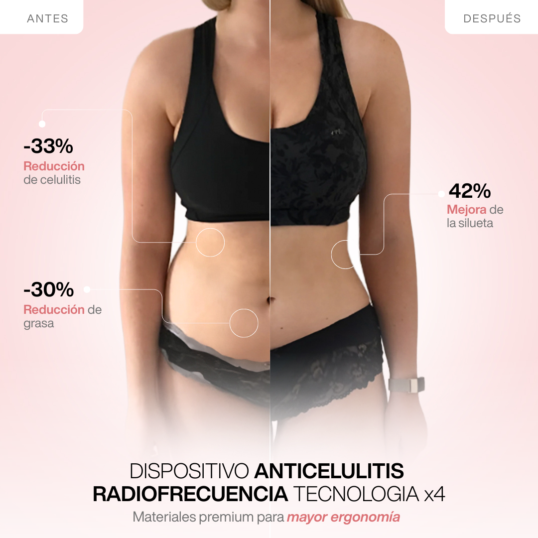Dispositivo Anticelulitis Radiofrecuencia Tecnología x4