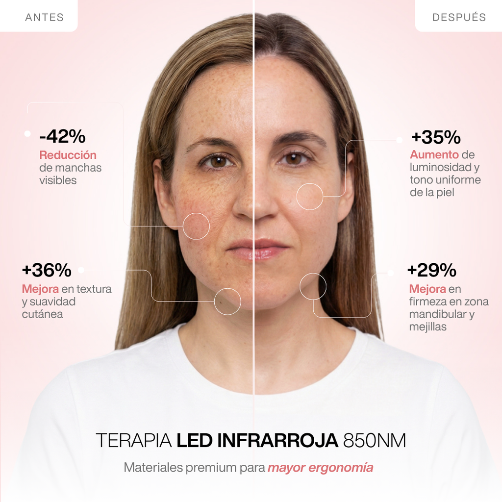 Kit Completo de Máscaras LED Infrarrojas 850nm – Silicona Médica para Rostro, Cuello y Escote