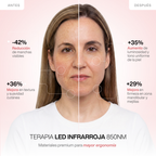 Kit Completo de Máscaras LED Infrarrojas 850nm – Silicona Médica para Rostro, Cuello y Escote
