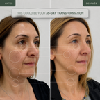 Lifting Facial Reafirmante y Alivio del Dolor - LED Infrarroja 830nm