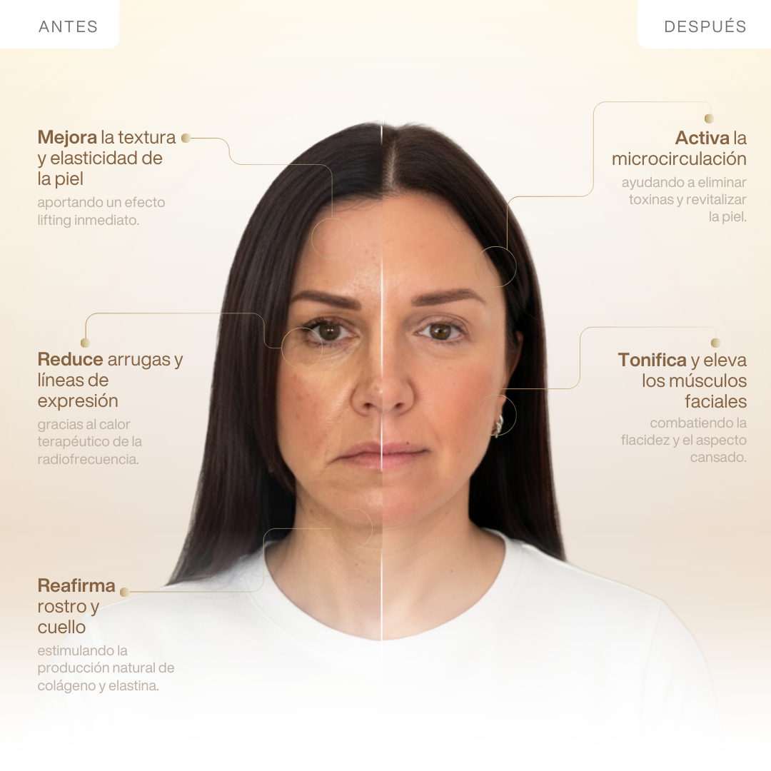 RF Lifting Oro 24K Facial y Cuello