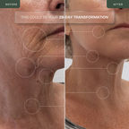 RF Lifting Oro 24K Facial y Cuello
