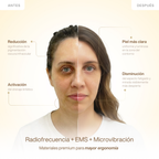 Eyes Perfector Oro 24K RF