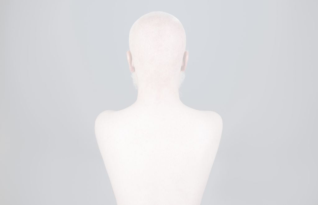 Overexposed Vol.3  LOTE 10 | Photography