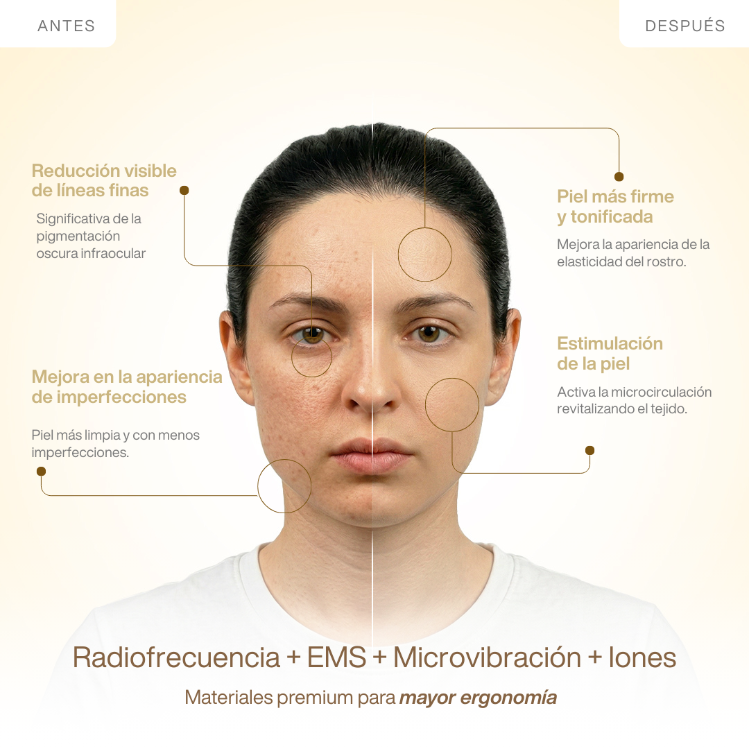 RF Multifunción Oro 24K Antiedad & Lifting