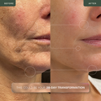 RF Multifunción Oro 24K Antiedad & Lifting