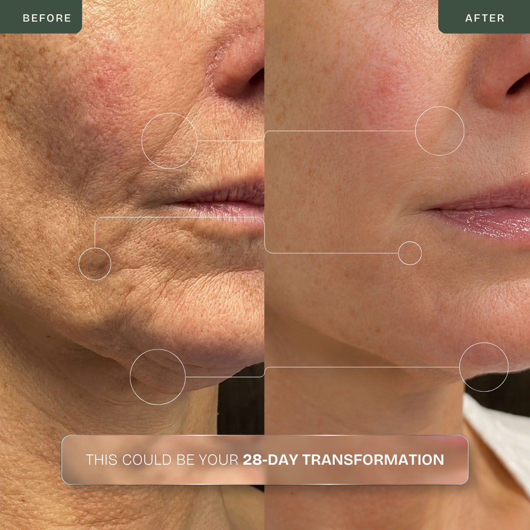 RF Multifunción Oro 24K Antiedad & Lifting