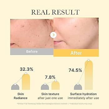 Mascarilla en Gel Iluminadora con Ácido Kójico y Cúrcuma 28g
