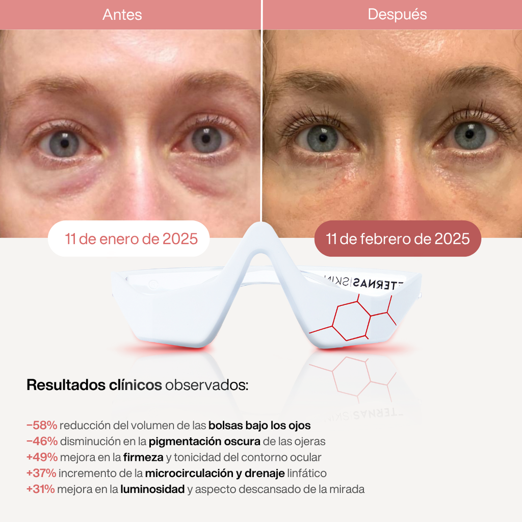 Reparador Bolsas y Ojeras con LED y Microcorriente