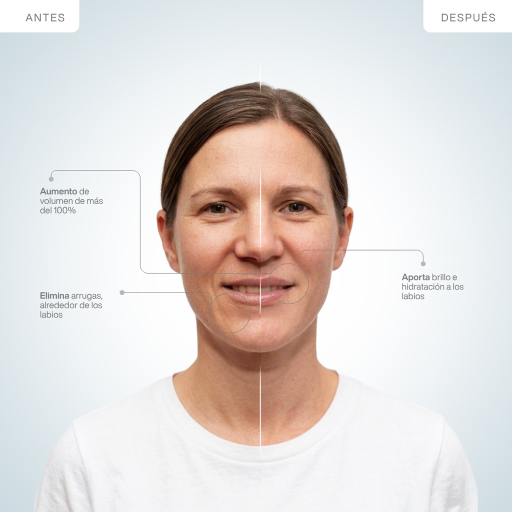Máscara de Labios LED Infrarroja 850nm Silicona Médica