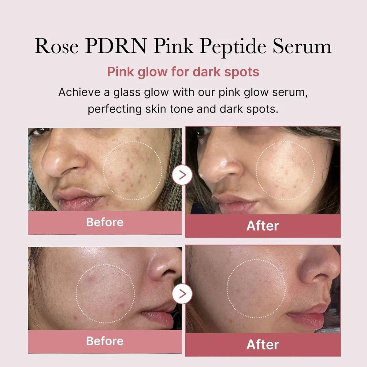 Medicube – PDRN Pink Glutathione Serum Mist | Bruma Iluminadora & Reparadora · Antioxidante
