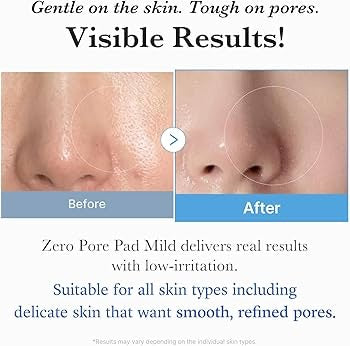 Medicube – Zero Pore Pad Mild (70 Piezas) | Exfoliación Suave para Poros & Piel Sensible