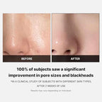Medicube – Zero Foam Cleanser 120g – Limpiador Facial Purificante para Poros y Sebo